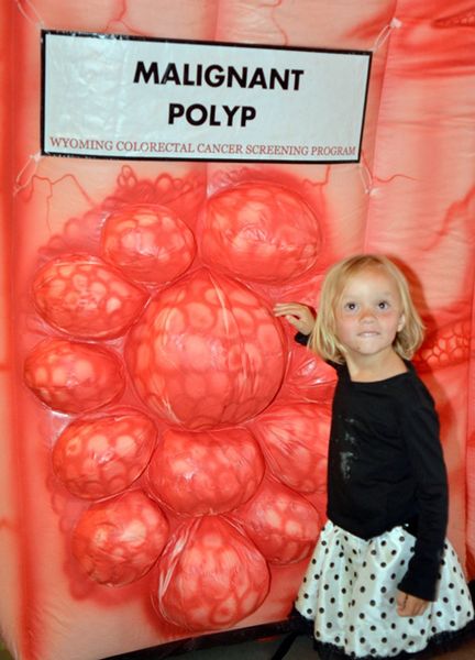 Eli Displays A Malignant Colon Polyp. Photo by Terry Allen.