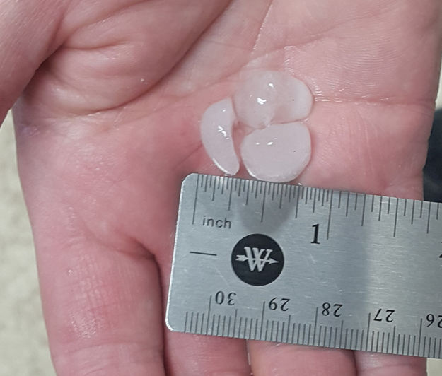 Large hail. Photo by Cody Sims.